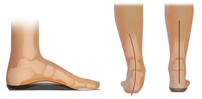 Footactive - Steunzolen
